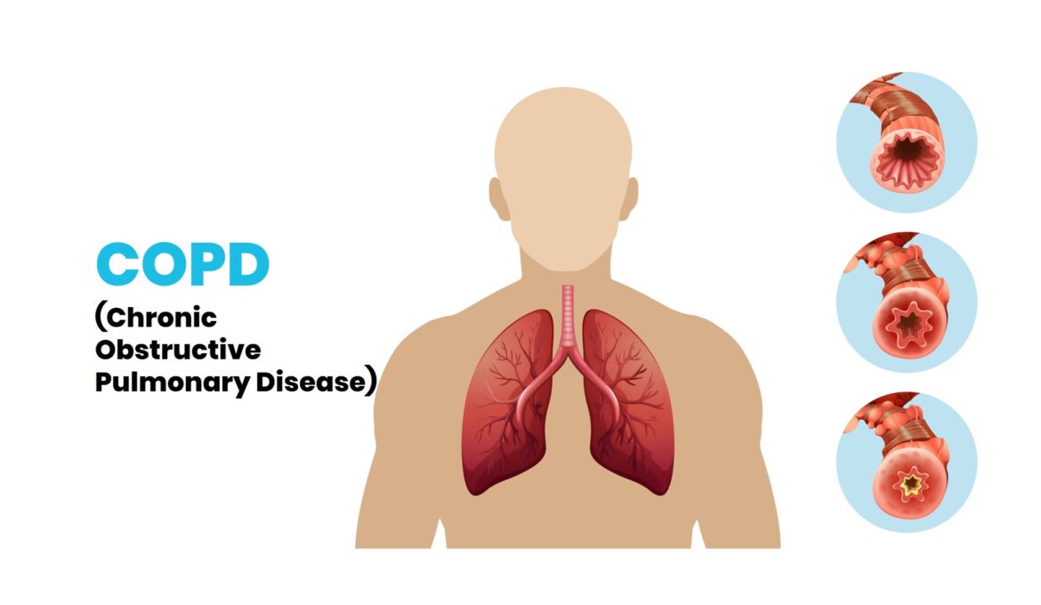 copd_banner