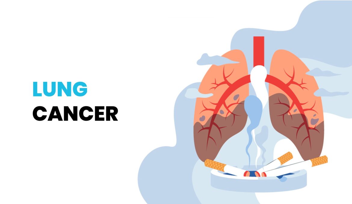 lung_cancer_banner