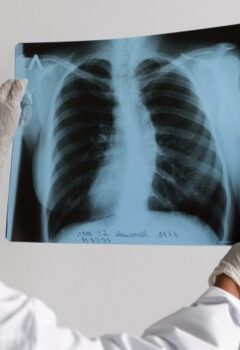 Expectations Before and After a Lung Transplant