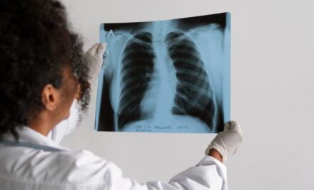 Expectations Before and After a Lung Transplant