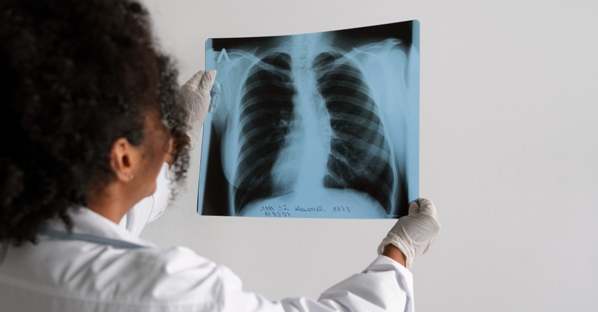 Expectations Before and After a Lung Transplant