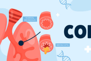 End-Stage COPD: What Are the Treatment Options Beyond Oxygen?
