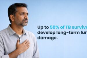 Post-Tuberculosis Lung Disease (PTLD): The Hidden Burden After TB Cure