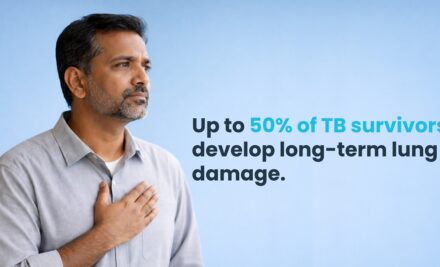 Post-Tuberculosis Lung Disease (PTLD): The Hidden Burden After TB Cure