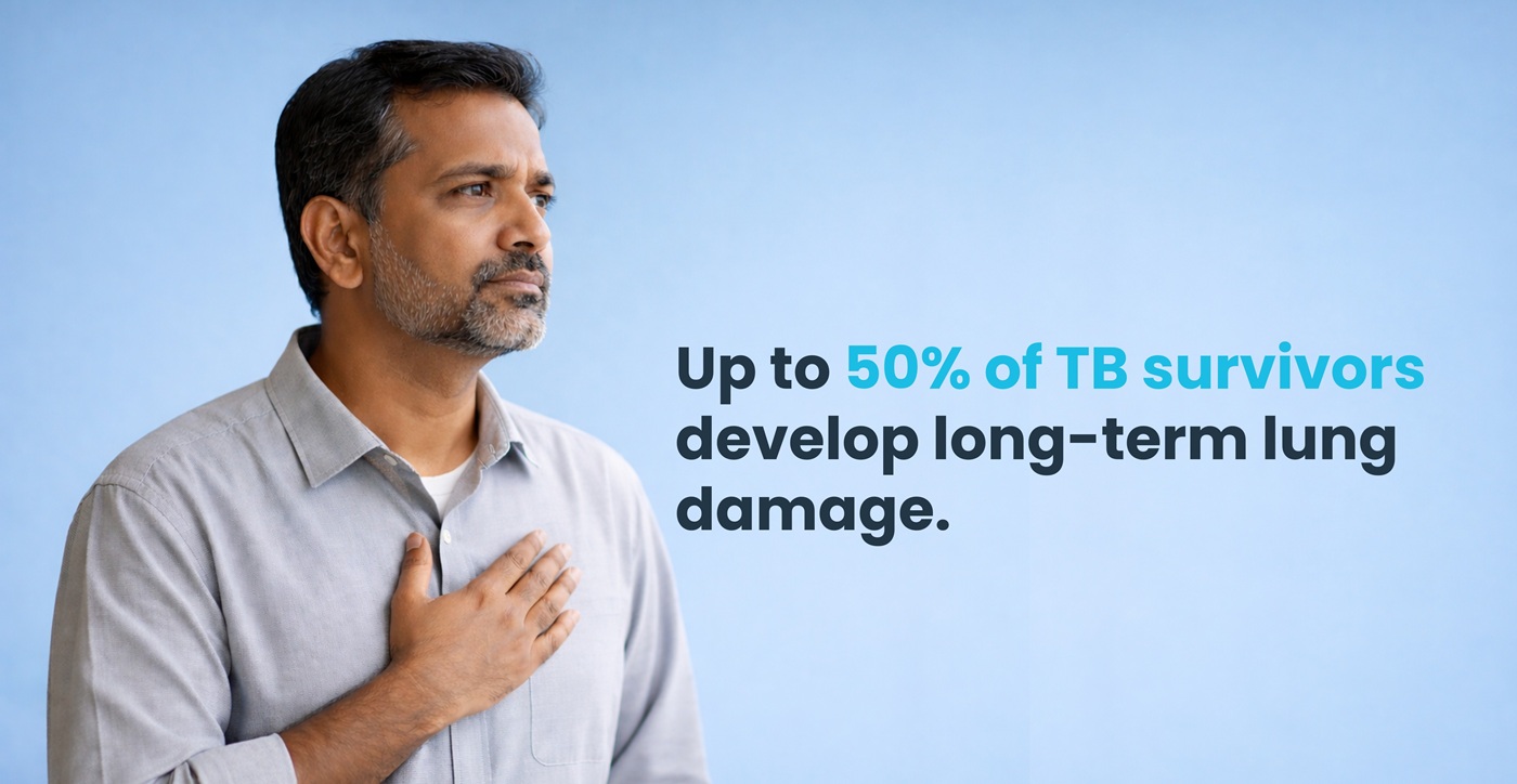 Post-Tuberculosis Lung Disease (PTLD): The Hidden Burden After TB Cure